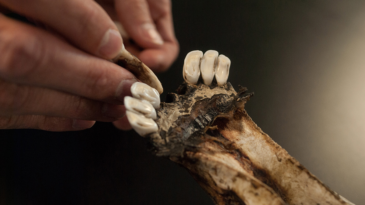 Cementum Aging Want the Truth? Slice the Tooth. Part II Rocky